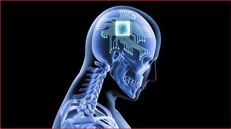 are they putting rfid chips in humans|Neuralink Implants Brain Chip in First Human: What It Means .